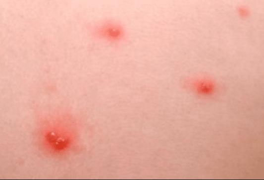 causes of red spots on skin