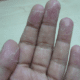 peeling-fingertips-1
