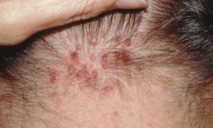 red-spots-causes-1