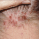 red-spots-causes-1