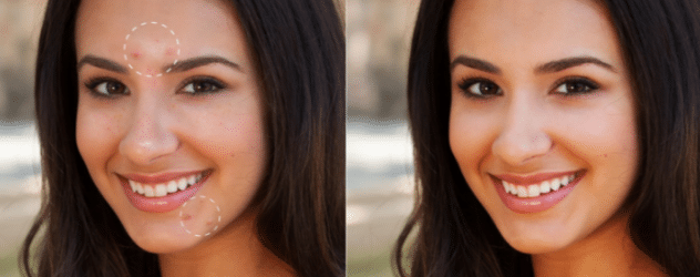 how to get rid of black spots from face