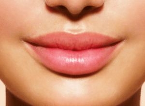 how-to-get-bigger-lips-300x219-1