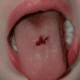 cut-on-tongue-picture-1