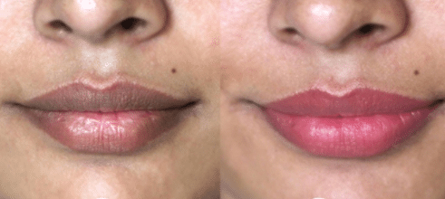 how to make lips pink naturally
