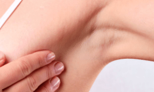 pain-under-left-armpit-female-1-1
