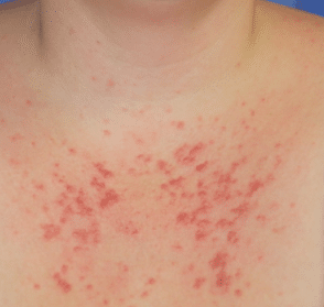 red spots on skin