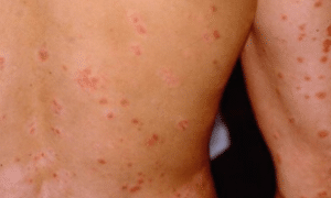 red-dots-on-skin-causes-1