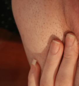 vulva itching causes