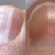 vertical-ridges-on-nails-1