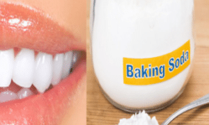 baking-soda-on-teeth-1