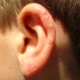 bumps-on-ears-1